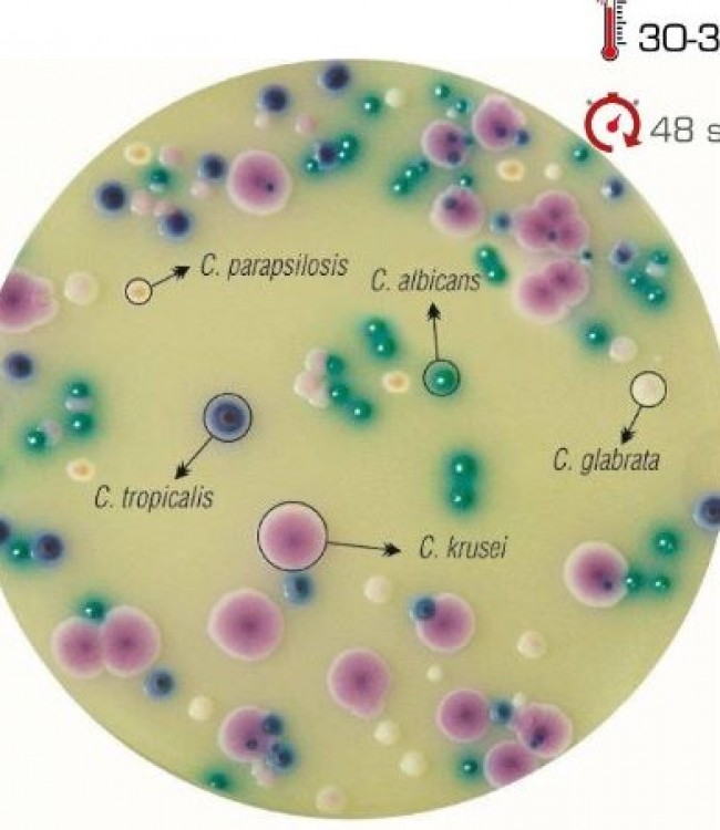 Candida Chromogenic Agar | estudioespositoymiguel.com.ar